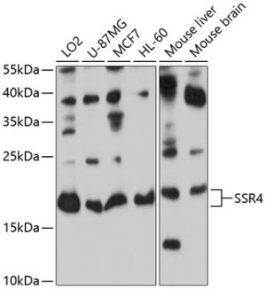 SSR4 Rabbit pAb