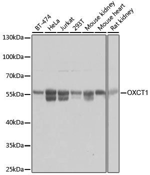 OXCT1 Rabbit pAb