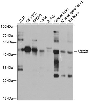 RGS20 Rabbit pAb