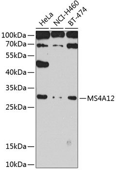 MS4A12 Rabbit pAb