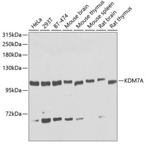 KDM7A Rabbit pAb