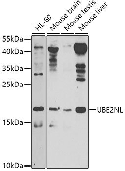 UBE2NL Rabbit pAb