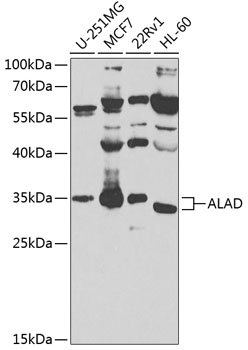ALAD Rabbit pAb