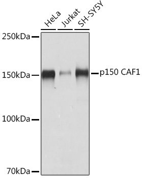 p150 CAF1 Rabbit mAb