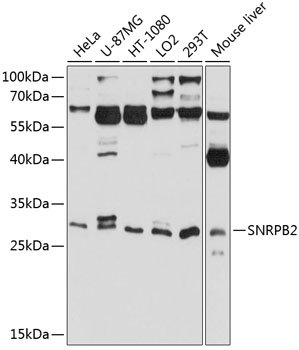 SNRPB2 Rabbit pAb