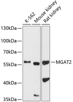MGAT2 Rabbit pAb