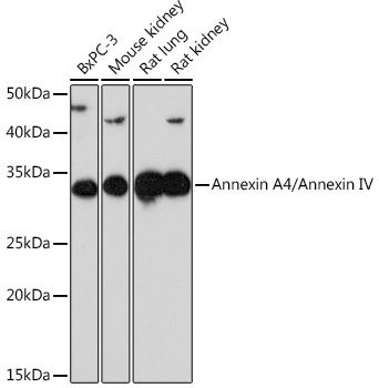 Annexin A4/Annexin IV Rabbit mAb