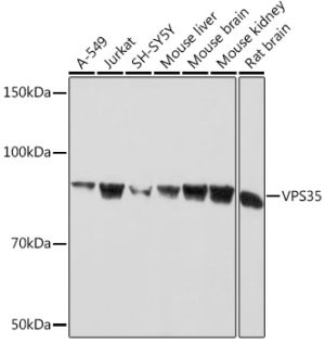 VPS35 Rabbit mAb