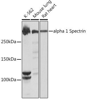alpha 1 Spectrin Rabbit mAb