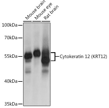 Cytokeratin 12 (KRT12) Rabbit pAb