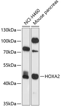 HOXA2 Rabbit pAb