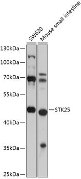 STK25 Rabbit pAb