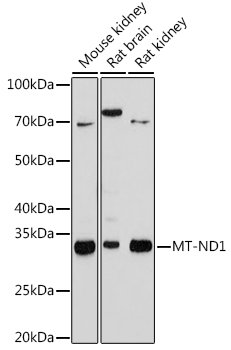 MT-ND1 Rabbit mAb