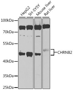 CHRNB2 Rabbit pAb