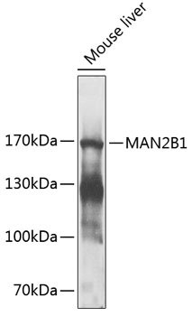 MAN2B1 Rabbit pAb