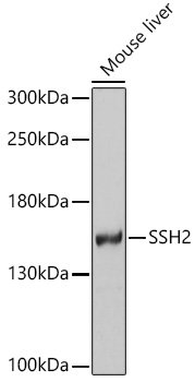 SSH2 Rabbit pAb