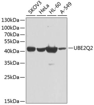 UBE2Q2 Rabbit pAb
