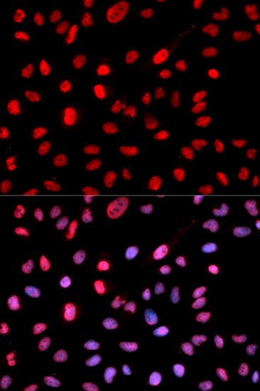 Phospho-DNMT1-S714 Rabbit pAb
