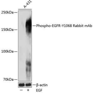 Phospho-EGFR-Y1068 Rabbit mAb