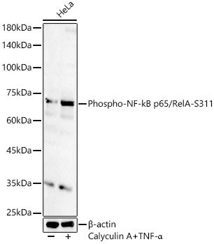 Phospho-NF-kB p65/RelA-S311 Rabbit pAb