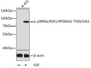 Phospho-p90Rsk/RSK1/RPS6KA1-T359/S363 Rabbit pAb