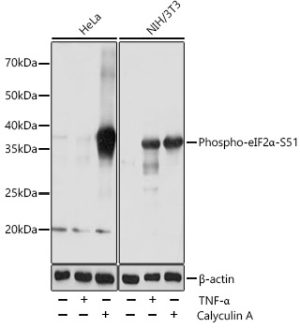 Phospho-eIF2α-S51 Rabbit mAb