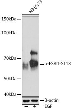 Phospho-ESRα-S118 Rabbit mAb