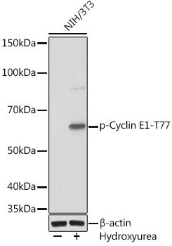 Phospho-Cyclin E1-T77 Rabbit mAb