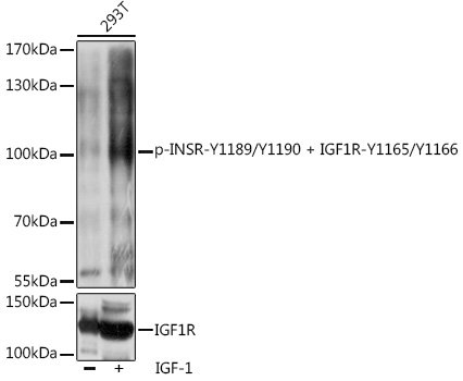 Phospho-INSR-Y1189/Y1190 + IGF1R-Y1165/Y1166 Rabbit pAb