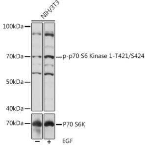 Phospho-p70 S6 Kinase 1-T421/S424 Rabbit pAb