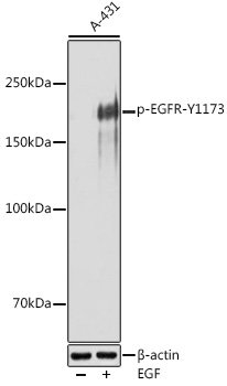 Phospho-EGFR-Y1173 Rabbit pAb