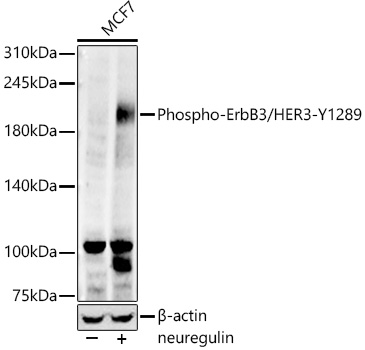Phospho-ErbB3/HER3-Y1289 Rabbit mAb