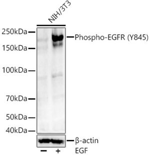 Phospho-EGFR-Y845 Rabbit mAb