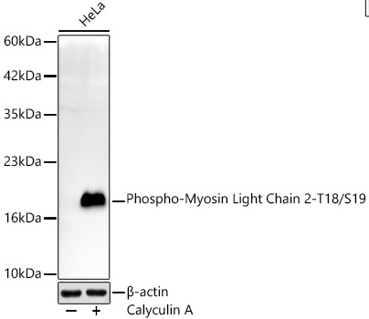 Phospho-Myosin Light Chain 2-T18/S19 Rabbit mAb