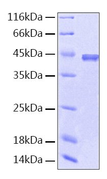 Recombinant Human Serpin F1/PEDF Protein