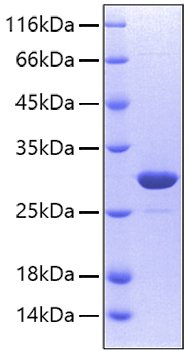Recombinant Human Carbonic anhydrase 2 Protein