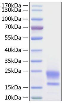 Recombinant Human WAP5/WFDC2/HE4 Protein