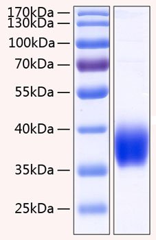 Recombinant Human Carbonic anhydrase 12 Protein