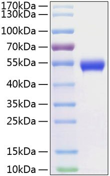 Recombinant Human CD5 Protein