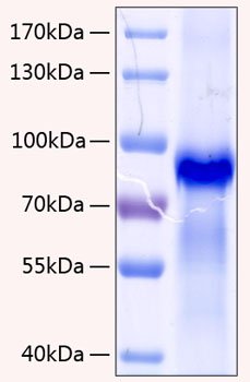 Recombinant Human Progranulin/PGRN/GRN Protein