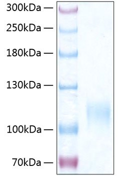 Recombinant Human E-selectin/SELE/CD62E Protein