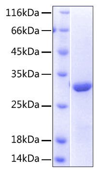 Recombinant Human NKG2-D/KLRK1/CD314 Protein