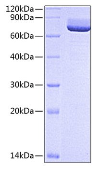 Recombinant Rat 5'-Nucleotidase/NT5E/CD73 Protein