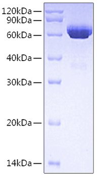 Recombinant Human Tissue-type plasminogen activator/TPA/PLAT Protein