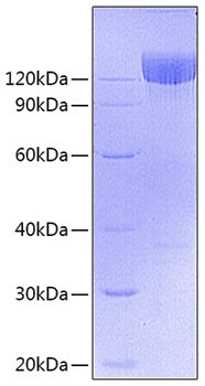 Recombinant Mouse PDGFR-alpha/CD140a Protein