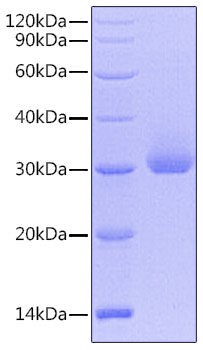 Recombinant Human Kallikrein-4/KLK4 Protein