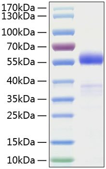 Recombinant Human Frizzled-1/FZD1 Protein