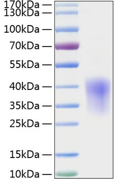 Recombinant Rat CCL2/MCP-1 Protein