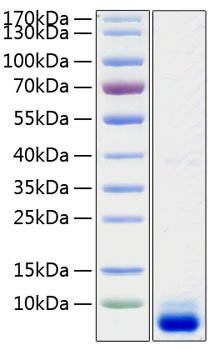 Recombinant Human Complement C5A Protein