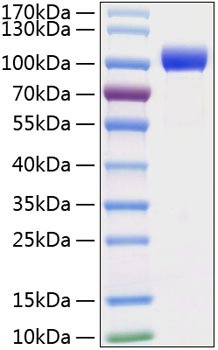 Recombinant Mouse MMP-9 Protein